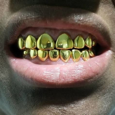 22k Permanent Gold Teeth Prices